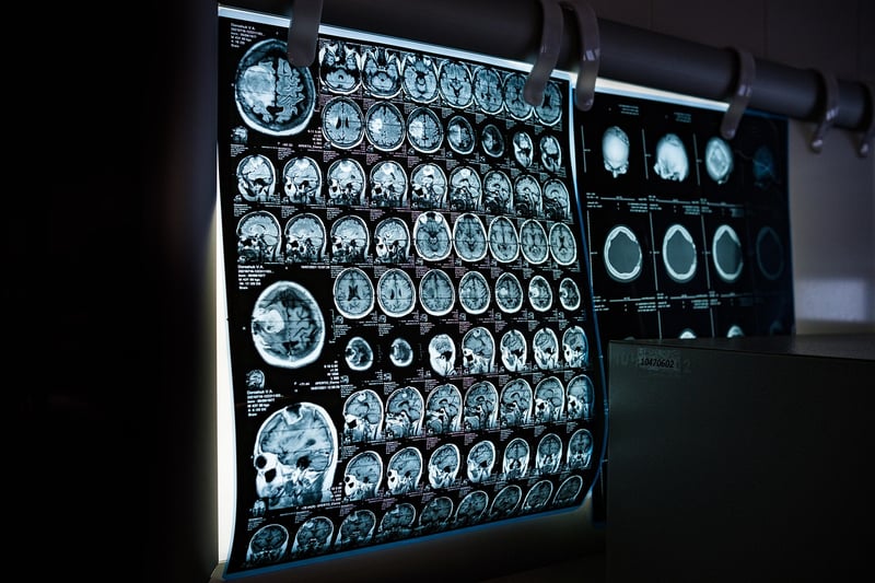 Body Scan Relaxation